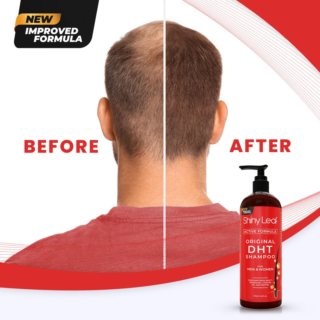 DHT Blocker Hair Loss Shampoo with Biotin — 16 oz
