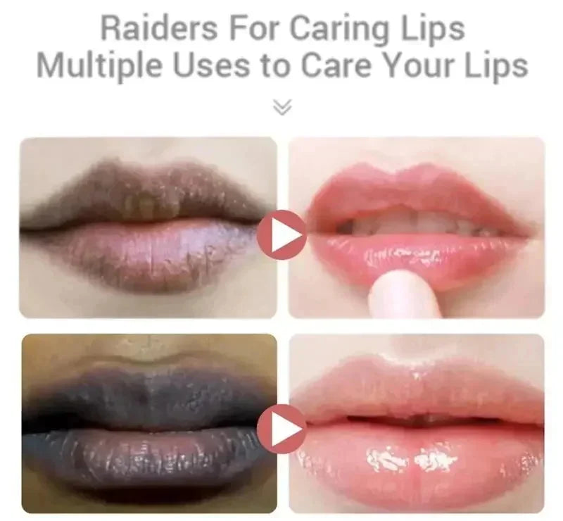 Remove Dark Lip Balm Moisturizing Lighten Melanin Bleaching Lip Gloss Lip Pink Lipstick Exfoliating Fade Lip Line Beauty Health