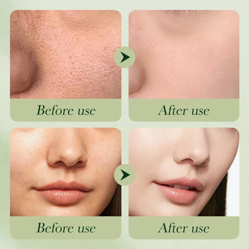Avocado Skincare 6-Piece Set Includes Nourishing And Moisturizing Eye Cream, Face Cream, And Anti-Wrinkle Skincare Products.