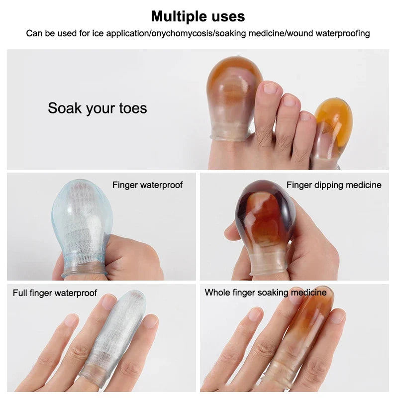 Waterproof Soak Potion Finger Cots – Protective Covers for Finger and Toe Injuries, Wounds, and Shower Protection