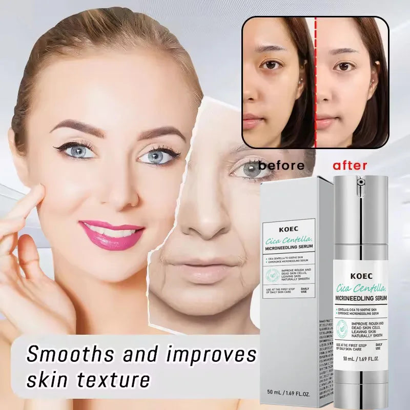 Korean Microneedle Essence Desalination Fine Lines Spots Collagen Solution Reverse Aging Recombinant Improves Rough Texture 50ml