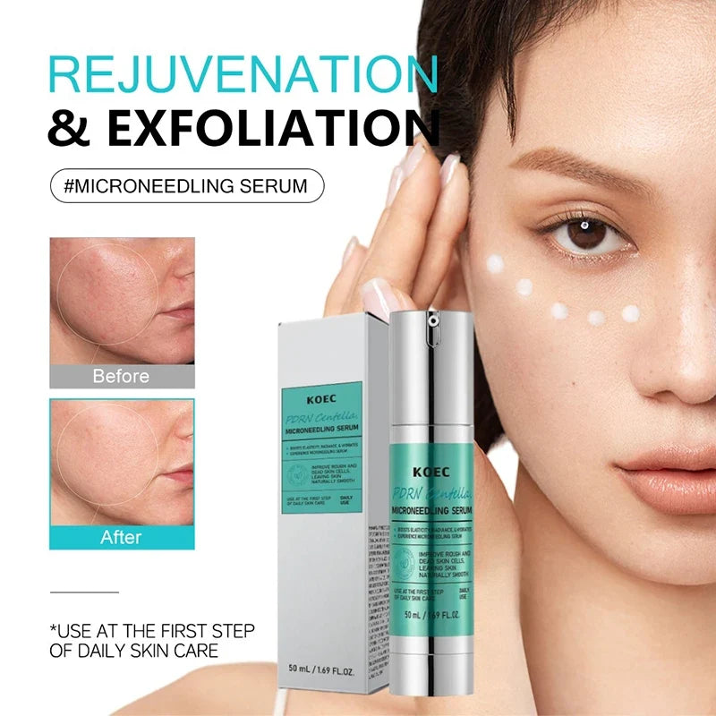 Spicule Microneedling Serum,Pore Exfoliation,Centella Asiatica Propolis Aloe Extract Moisturizing Booster,Korean Glass Skin Care