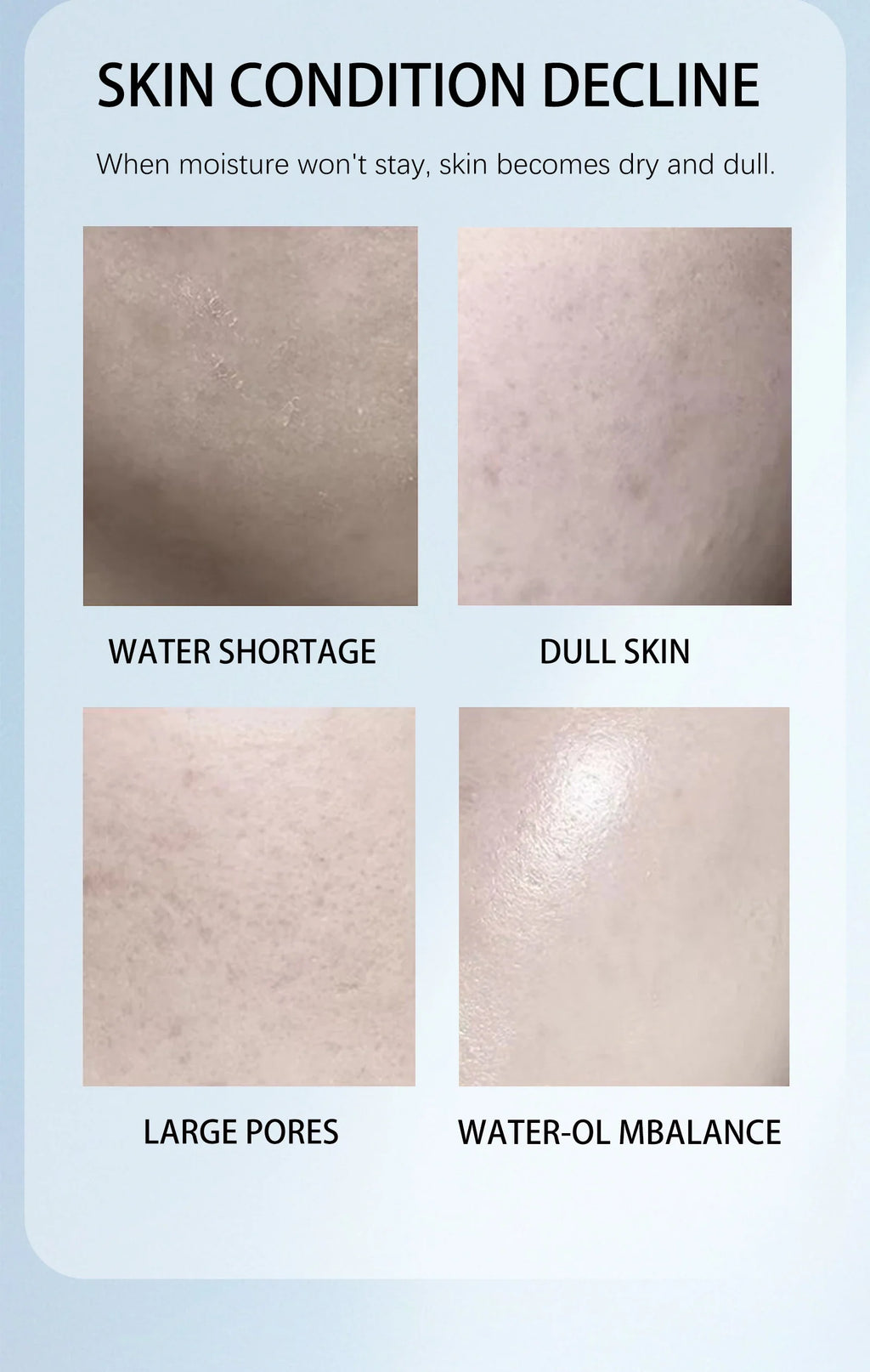Niacinamide face cream, minimizes pores, moisturizes, suitable for oily skin, effectively hydrates.