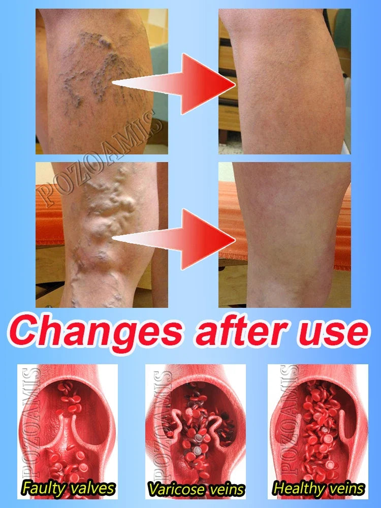 Non-invasive, home-use, portable, no surgery required