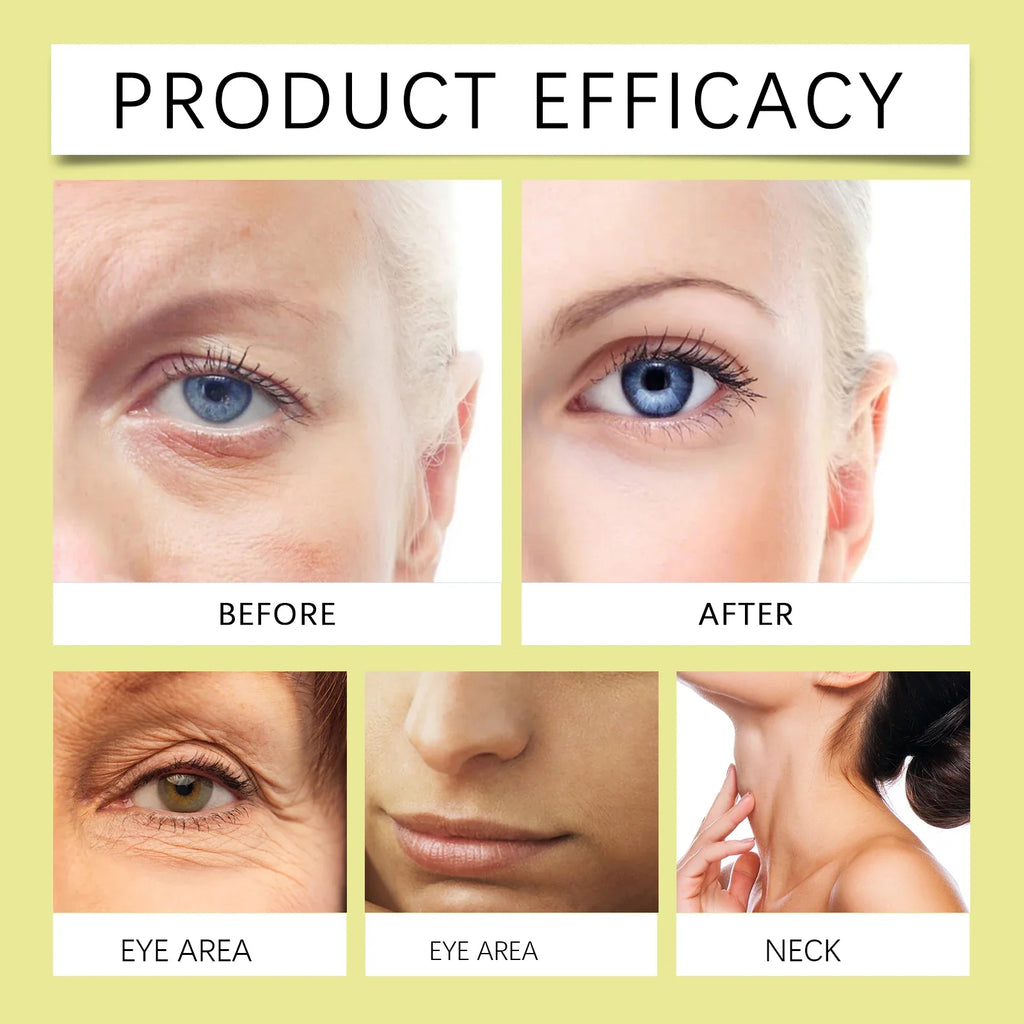 Anti-Aging Retinol Cream For Women Firming Brightening Face Moisturizer Deep Hydration Night Cream For Dry Sensitive Skin Winter