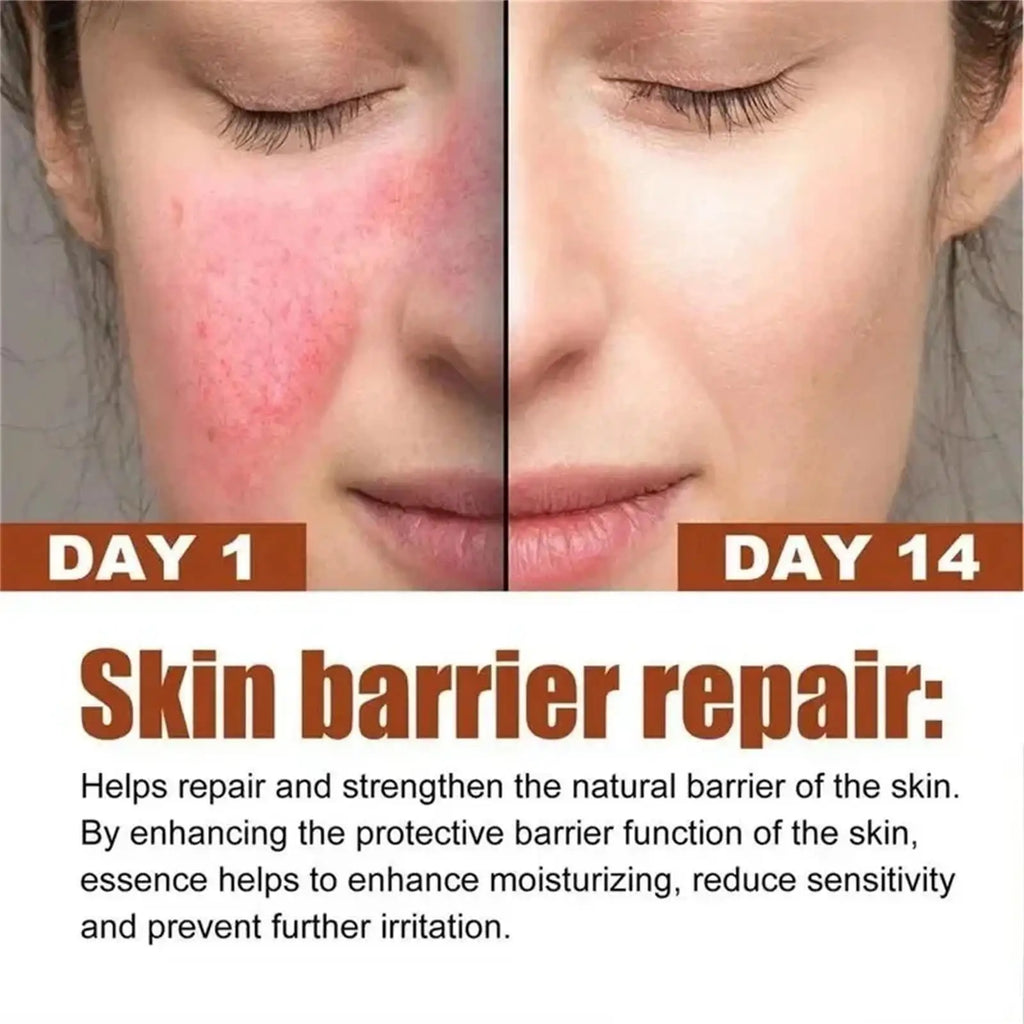 Facial Redness Repair Capsule Oil Improve Sensitive Skin Dryness Moisturizer Soothing Serum Removal Rosacea Korean Cosmetics