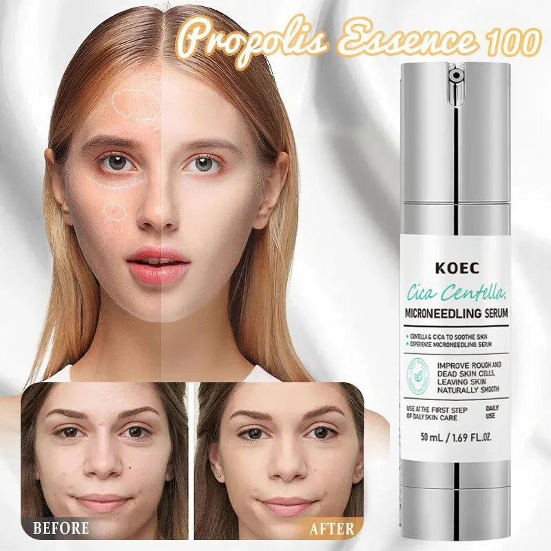 Korean Microneedle Essence Desalination Fine Lines Spots Collagen Solution Reverse Aging Recombinant Improves Rough Texture 50ml