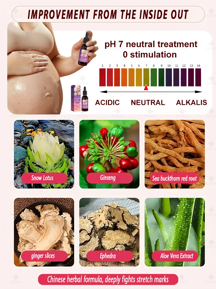 Stretch mark repair, easy removal at home