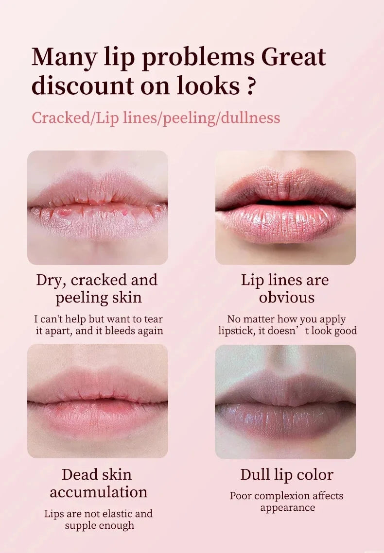 Remove Dark Lip Balm Moisturizing Lighten Melanin Bleaching Lip Gloss Lip Pink Lipstick Exfoliating Fade Lip Line Beauty Health