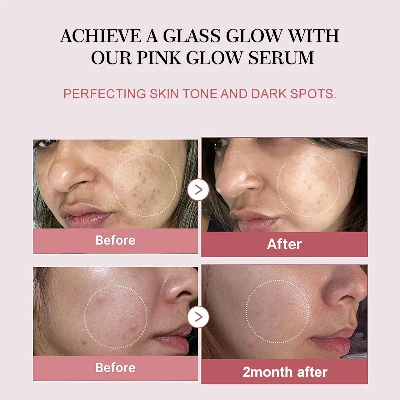 Complex Peptide Acne Serum PDRN Collagen Shrink Pores Fade Melanin Smooth Brightening Skin Korean Skincare Products